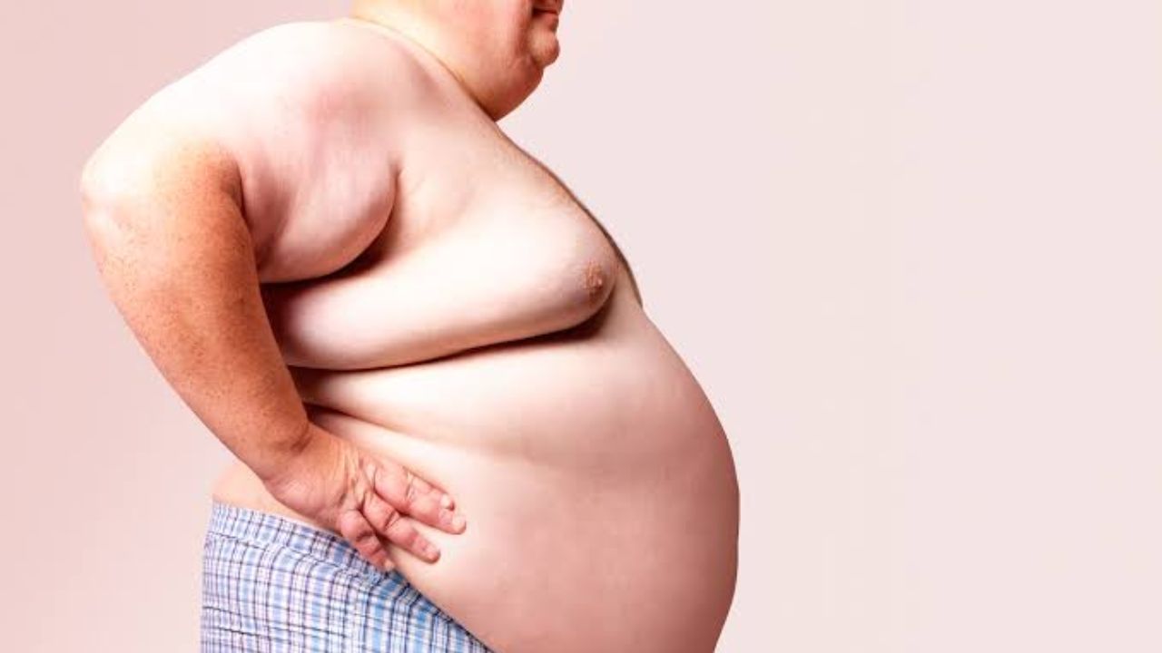 Obesity: Causes, Health Risks, and Simple Ways to Stay Fit